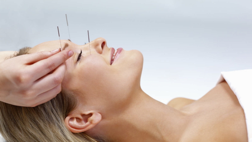 facial acupuncture